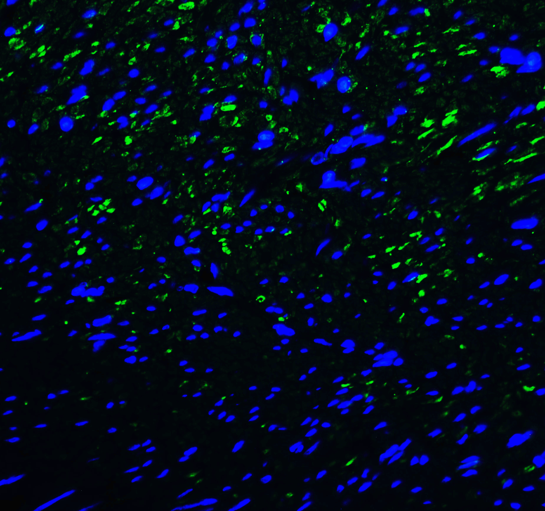 Monoclonal Mouse anti-Human HAVCR2 / TIM-3 Antibody (clone 1B10, IHC, IF, WB)
