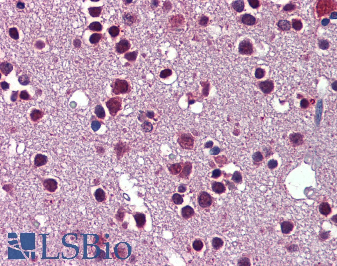 SRSF3 / SRP20 Antibody (aa38-87)