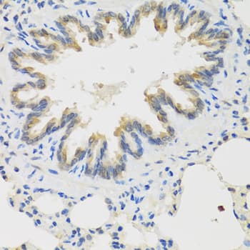 Polyclonal Rabbit anti-Human TICAM1 / TRIF Antibody (IHC, WB)