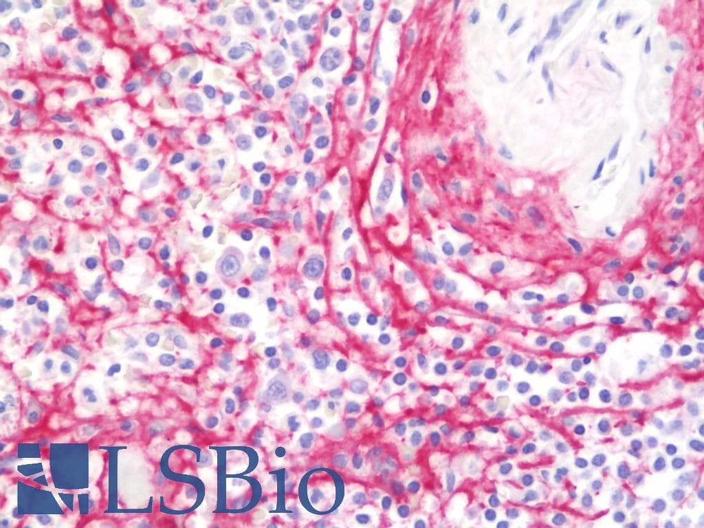 IHC-plus™ COL6A2 / Collagen VI Alpha 2 Antibody (clone 2C5-F2)