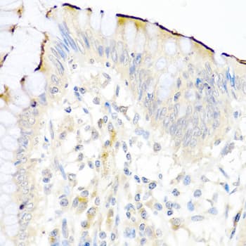 NRG4 Antibody