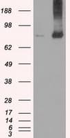 IHC-plus™ KIND2 / FERMT2 Antibody (clone 9E4)