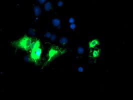KCNJ3 / GIRK1 Antibody (clone OTI1G3)