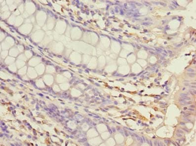 Polyclonal Rabbit anti-Human USP30 Antibody (aa101-400, IHC)