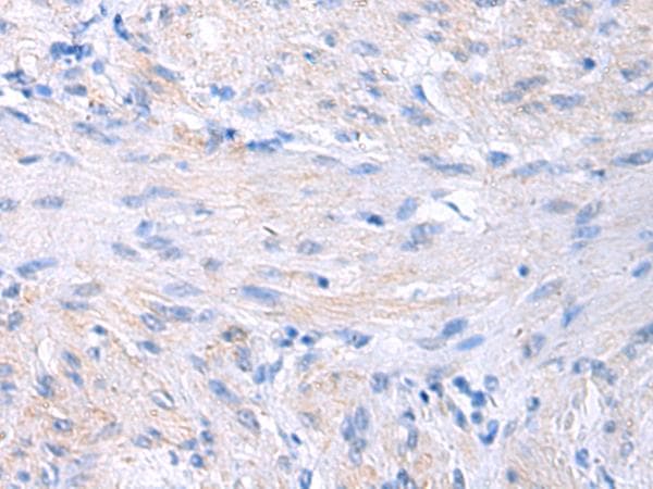 Polyclonal Rabbit anti-Human PROC / Protein C Antibody (IHC)