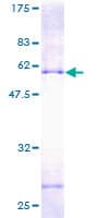 Human PECR Protein (Recombinant GST)