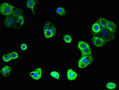 Polyclonal Rabbit anti-Human GPR176 Antibody (WB)