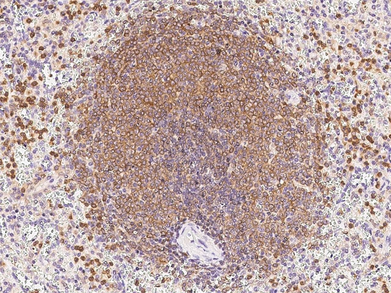 DOK3 Antibody (Preservative Free)