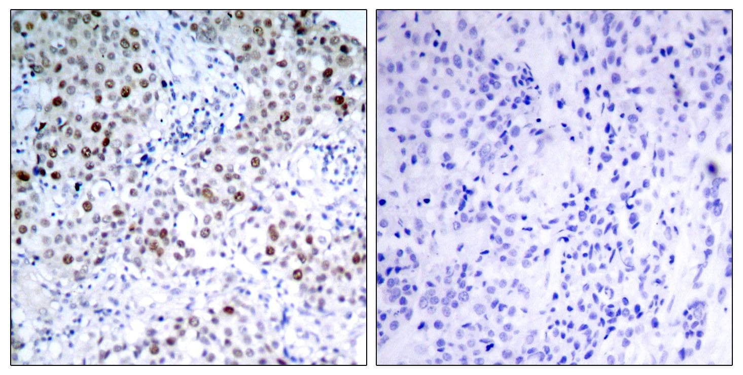 TP53 / p53 Antibody (phospho-Ser6)