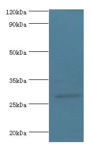 NMNAT3 Antibody (aa1-215)
