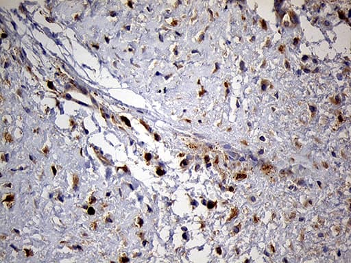 PYGM Antibody (aa698-842, clone OTI5D1, Carrier-free)