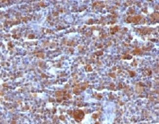 BAX Antibody (clone BAX/962)