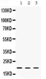 Polyclonal Rabbit anti-Human CFL2 / Cofilin 2 Antibody (IHC, WB)