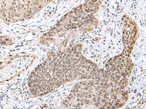 TCF25 Antibody