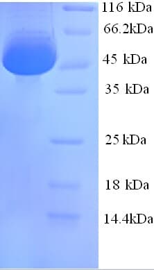 Mouse CALR / Calreticulin Protein (Recombinant 6His, N-terminus)