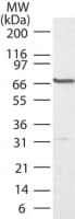 IHC-plus™ Polyclonal Rabbit anti-Human PLK1 / PLK-1 Antibody (aa100-200, IHC, WB)