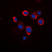 ATP6AP2 / Renin Receptor Antibody (Internal)