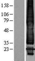 TWIK1 / KCNK1 Protein (Over-Expression Lysate Myc-DDK (Flag))