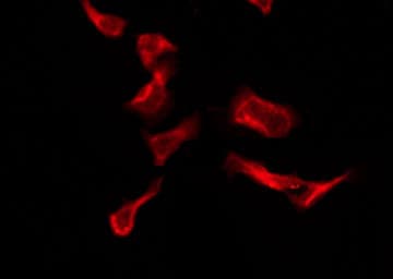 P2RY4 / P2Y4 Antibody