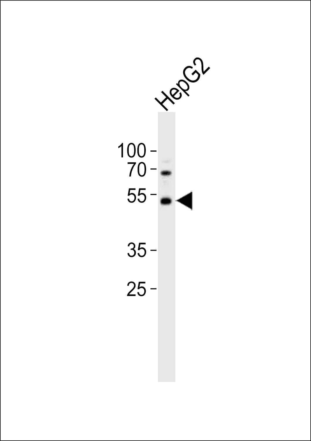 Polyclonal Rabbit anti-Human PAX6 Antibody (aa183-214, WB)