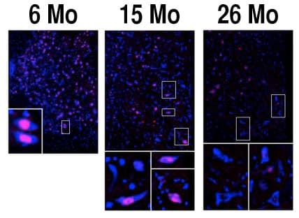 ADAR2 / ADARB1 Antibody