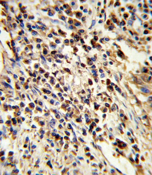 PSMA7 Antibody (aa100-126)