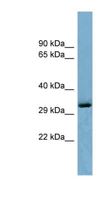 OTUD6B Antibody (C-Terminus)