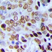 POLR3E / SIN Antibody (Internal)