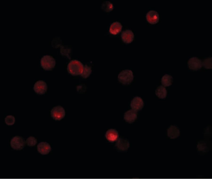 IHC-plus™ Polyclonal Rabbit anti-Human CABP7 Antibody (IHC, IF, WB)
