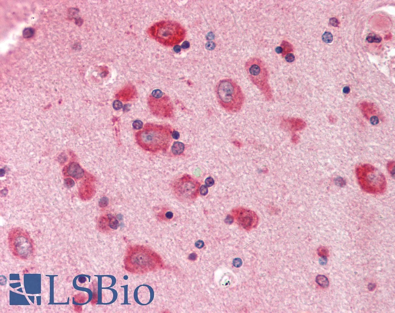 PYCR1 Antibody (aa215-264)