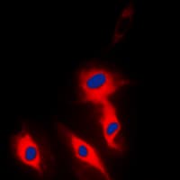 Polyclonal Rabbit anti-Human EFNA5 / Ephrin A5 Antibody (Internal, IHC, IF, WB)