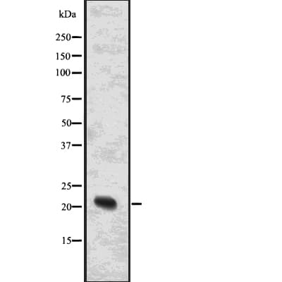 NRAS / N-ras Antibody