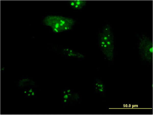 RPL23A Antibody (clone 3E11)