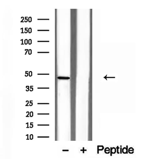 Polyclonal Rabbit anti-Human NOB1 / NOB1P Antibody (IHC, WB)