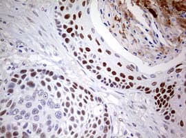Monoclonal Mouse anti-Human NAB1 Antibody (clone OTI5F2, aa237-487, IHC, WB)