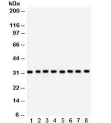 SMN1/SMN2 Antibody