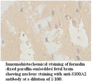 Polyclonal Rabbit anti-Human S100A2 Antibody (aa2-96, IHC)