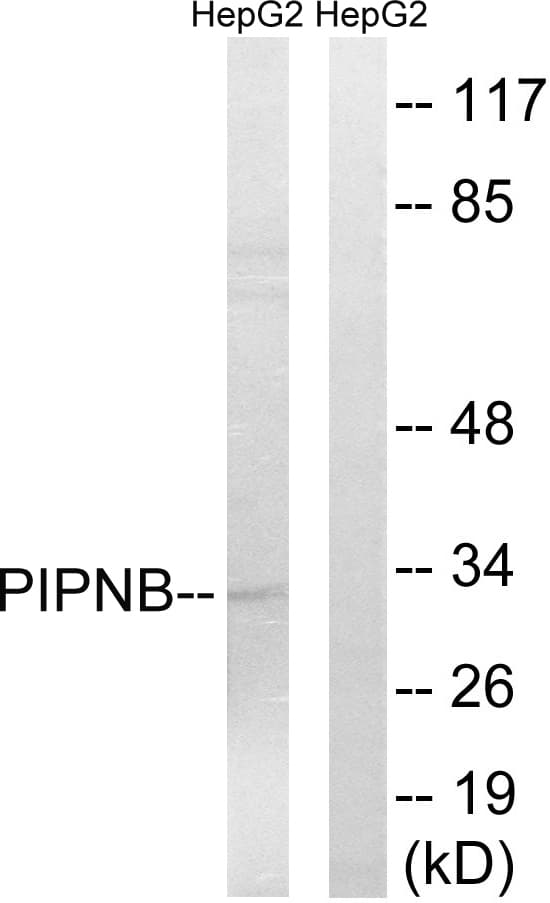 PITPNB Antibody (aa20-69)