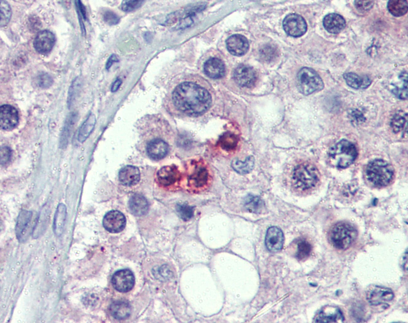 STAT5B Antibody (N-Terminus)