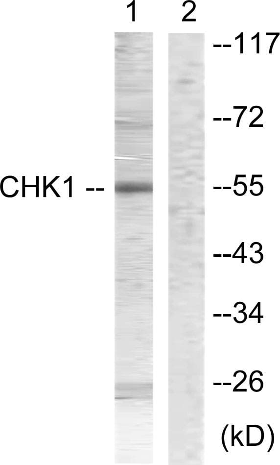 CHEK1 / CHK1 Antibody (p286)