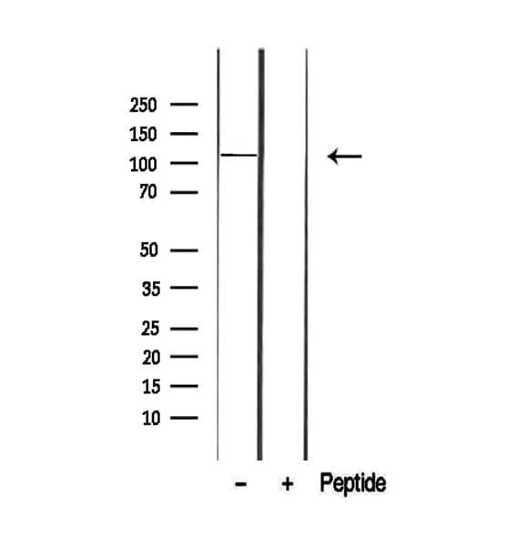 Polyclonal Rabbit anti-Human RBL1 / p107 Antibody (IHC, WB)