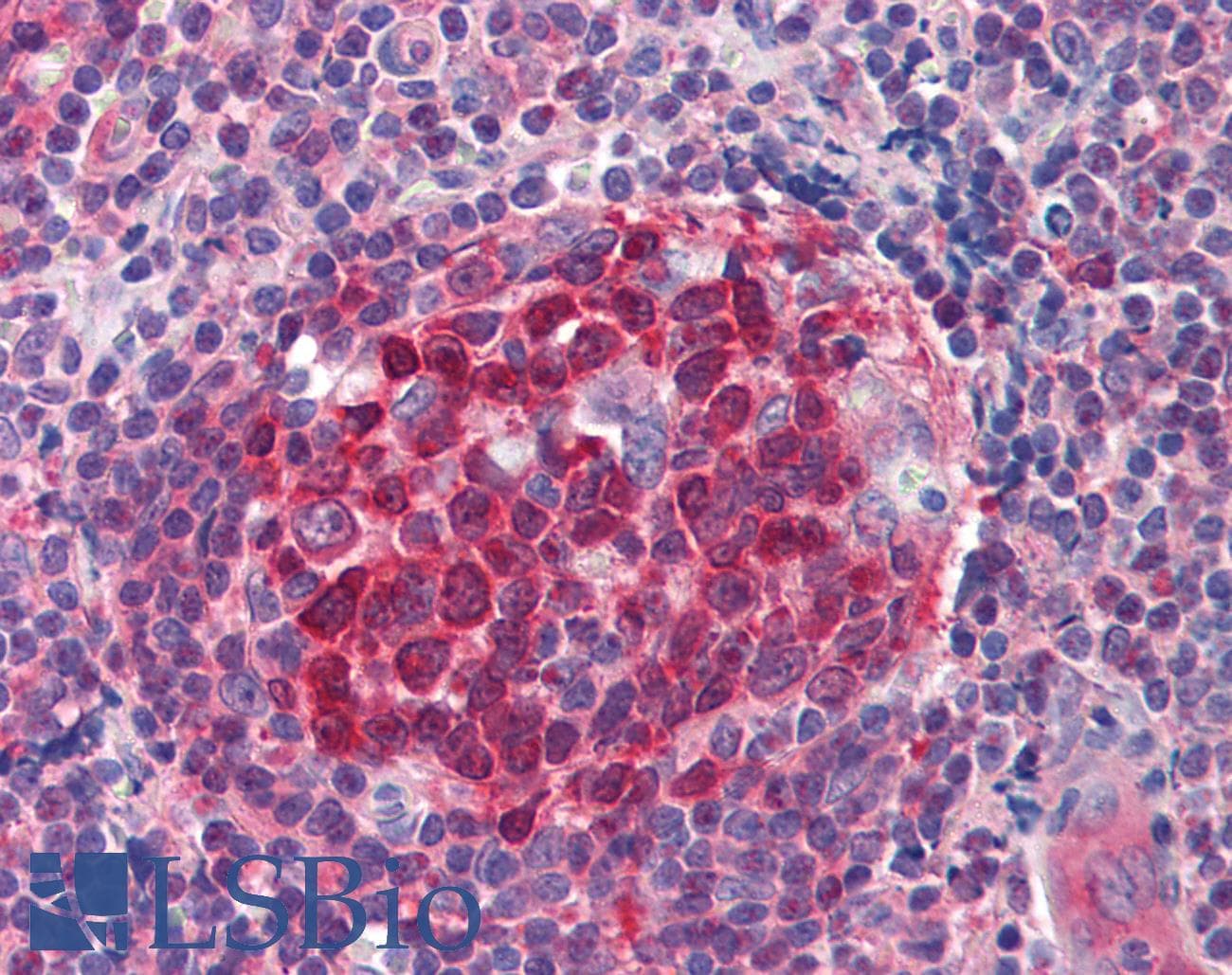 IHC-plus™ RRM2B / P53R2 Antibody