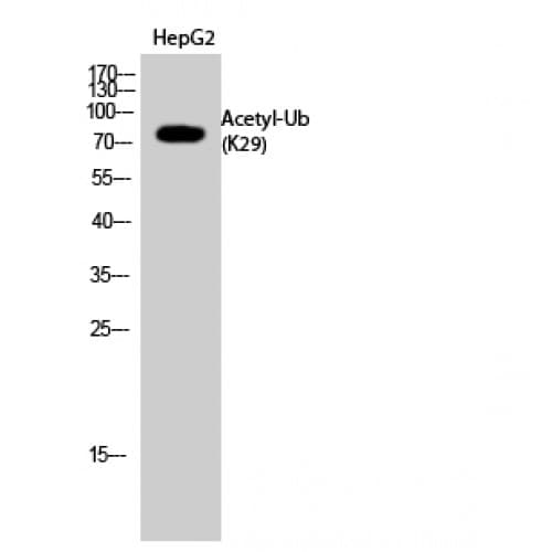 Ubiquitin Antibody (around the acetylation site of K29.)