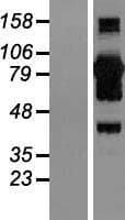 CALCOCO1 / CoCoa Protein (Over-Expression Lysate Myc-DDK (Flag))