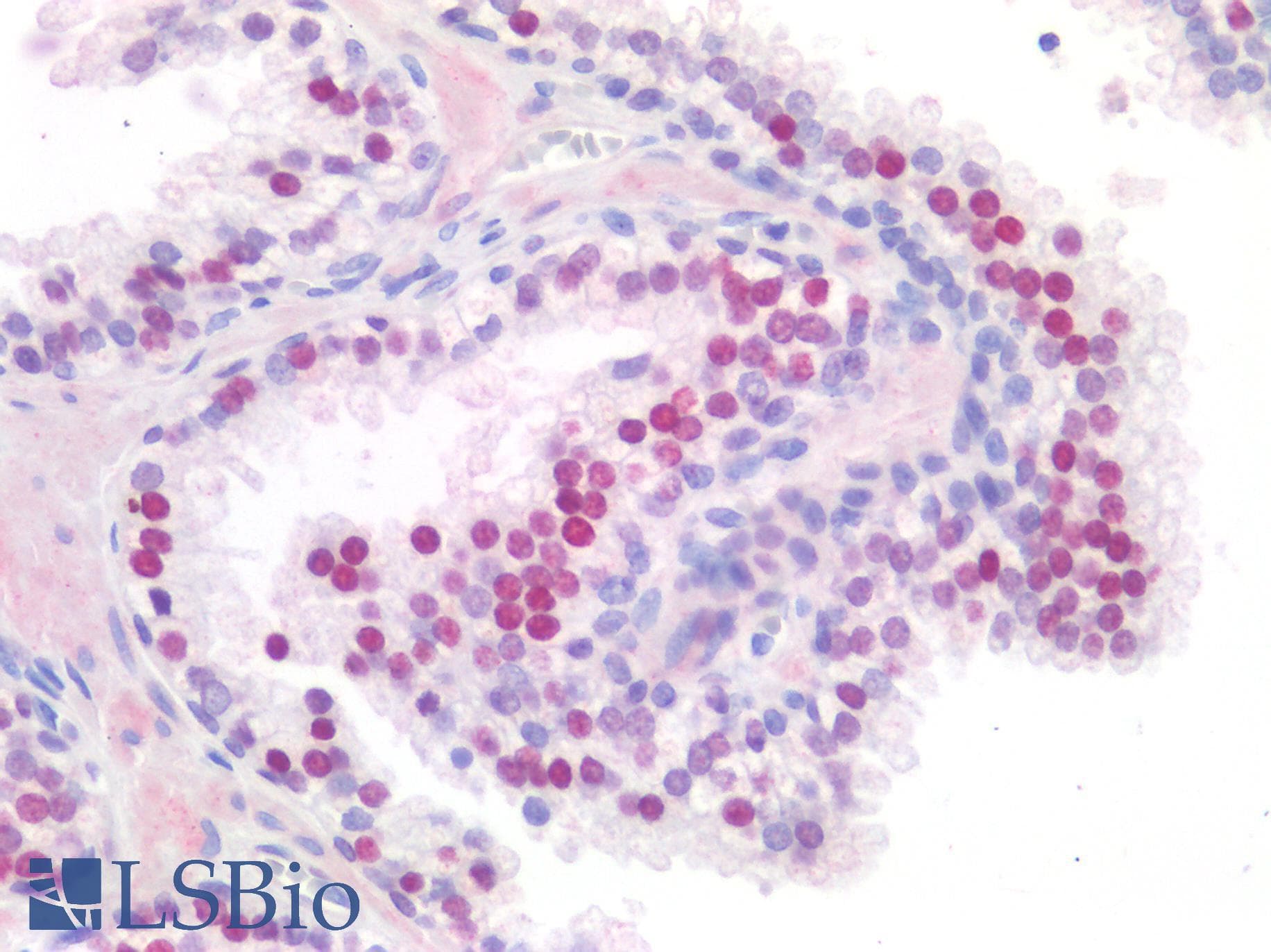 IHC-plus™ Polyclonal Rabbit anti-Human FOXA1 Antibody (IHC)