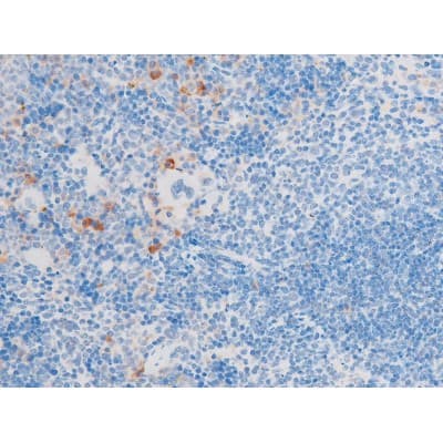 LIMK1 / LIMK Antibody (phospho-Thr508)