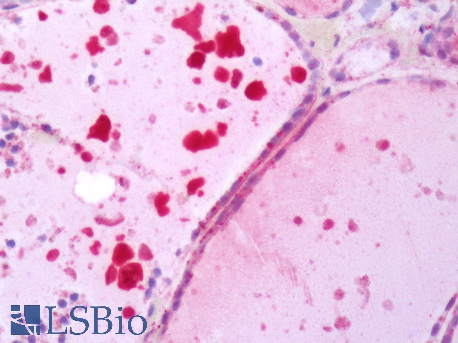 IHC-plus™ TSH Receptor / TSHR Antibody (N-Terminus)