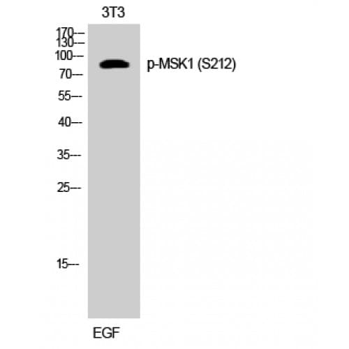 Polyclonal Rabbit anti-Human RPS6KA5 / MSK1 Antibody (150-230 aa, IHC, WB)