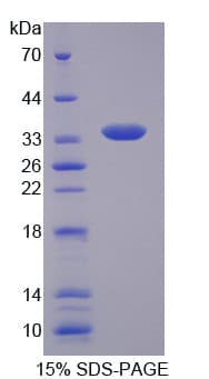 Human Endonuclease G / ENDOG Protein (Recombinant His-T7)