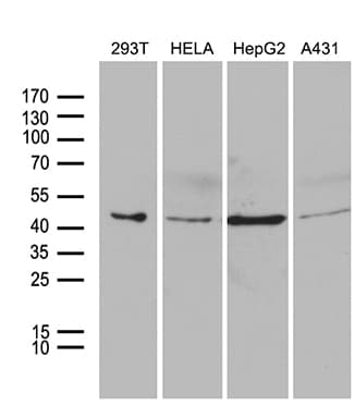 PSMC3 Antibody (aa353-438, clone OTI8D2, Carrier-free)